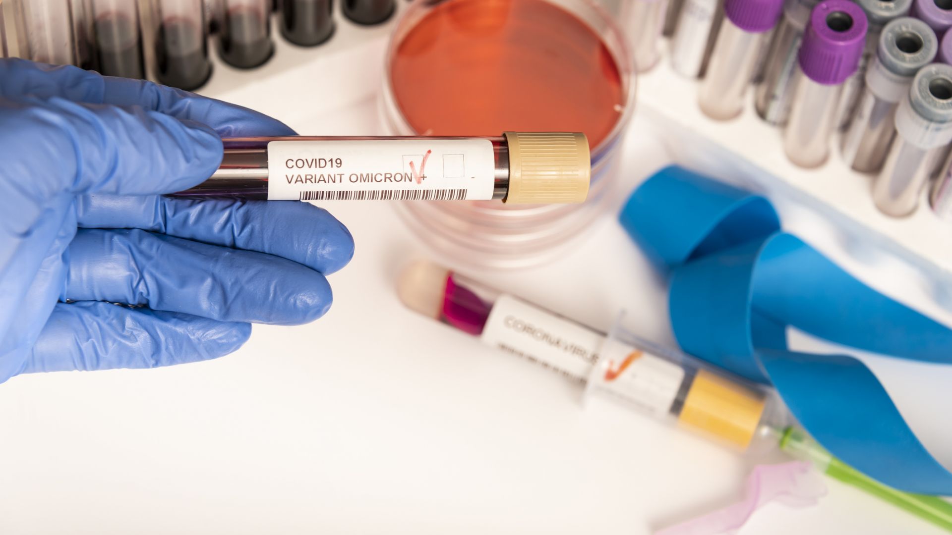 Близо 2000 положителни проби за коронавирус, което е 11,96% от тестваните