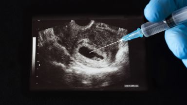 Германският правосъден министър Марко Бушман съобщи че ще внесе идния