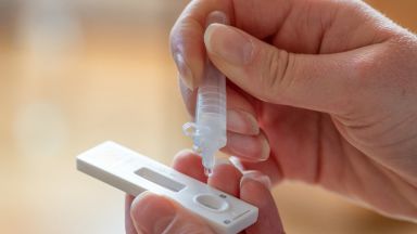 Коронавирусът: Близо 30% положетелни тестове