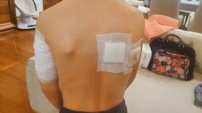 Дете беше нахапано от домашен питбул на детска площадка в