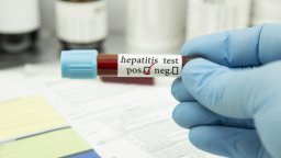Има съмнителни проби на неизвестния хепатит в България