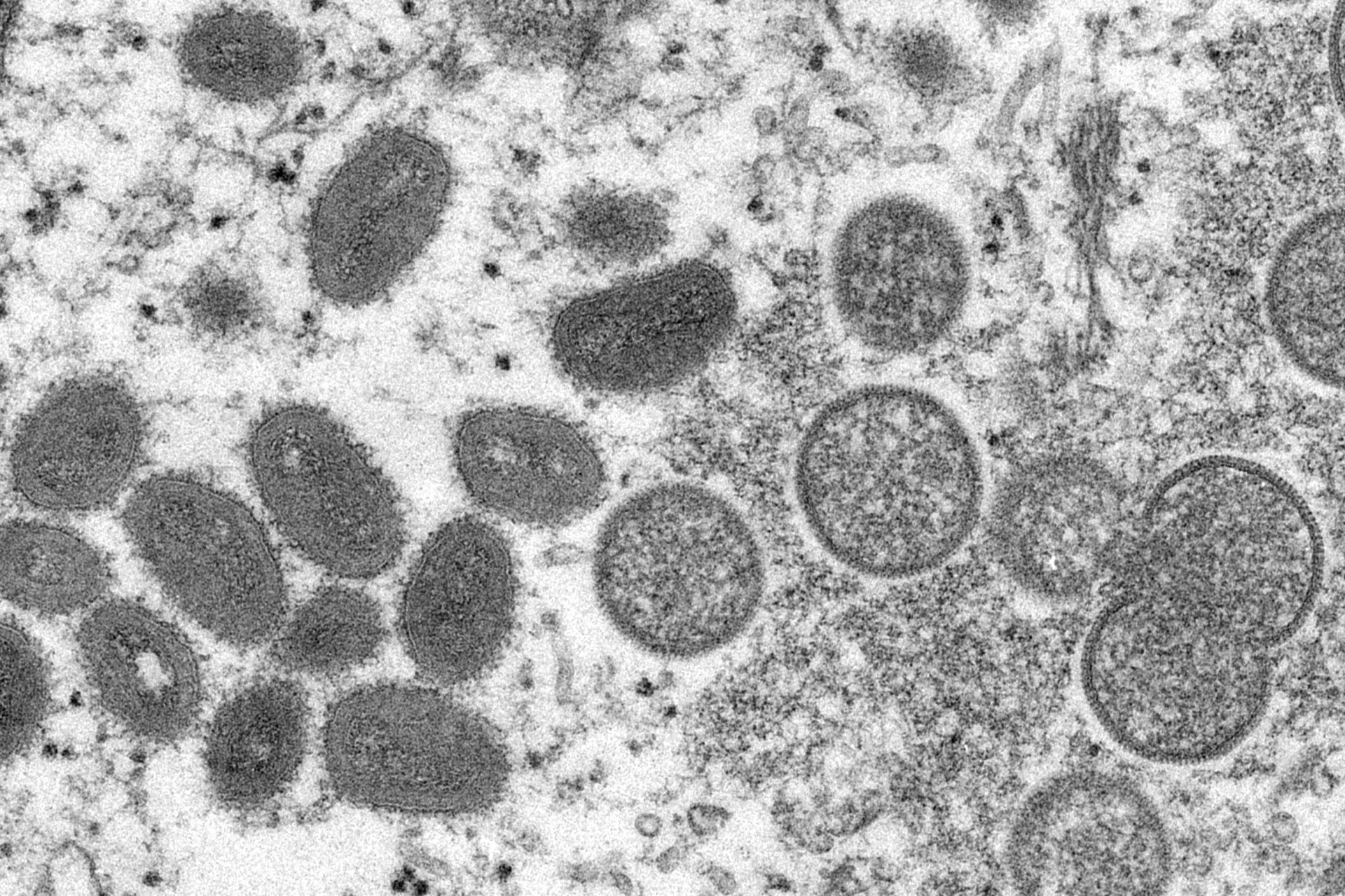 Изображение с електронен микроскоп от 2003 г., предоставено от Центровете за контрол и превенция на заболяванията, показва зрели вириони на маймунска шарка с овална форма, леви и сферични незрели вириони, вдясно, получени от проба от човешка кожа