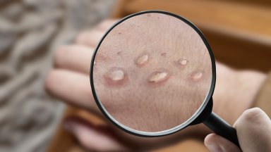 Световната здравна организация СЗО обяви днес решението си да преименува