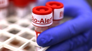 Шести случай на маймунска шарка е потвърден у нас на