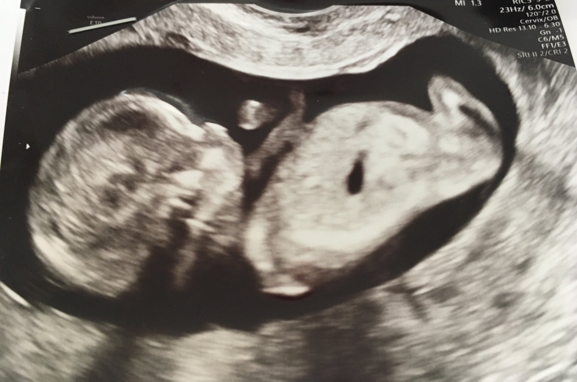 Лео за първи път пред очите на мама в третия месец от бременността 
