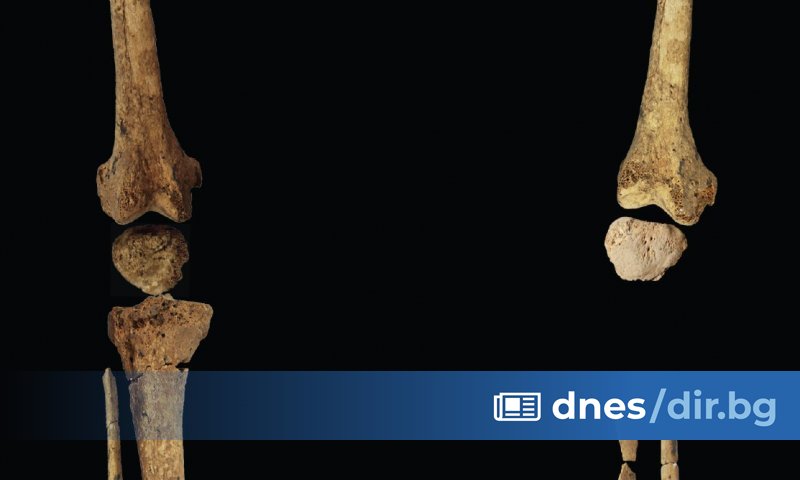 Скелет на 31 000 години на млад мъж с липсваща