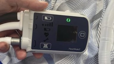 Екипът на проф д р Димитър Петков от Клиниката по сърдечна