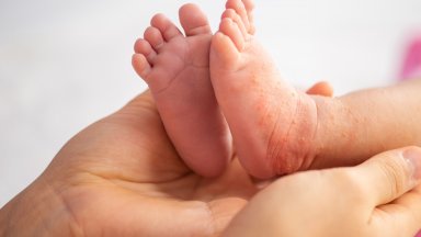 Кожата е най големият орган в човешкото тяло и единственият изцяло