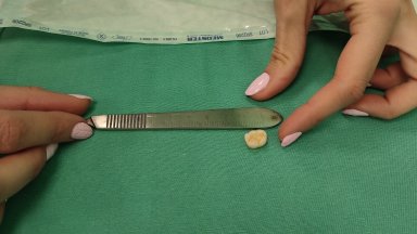 Лекари от Клиниката по УНГ болести в Университетската болница в Бургас