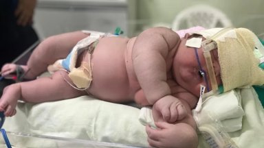 Бебе с тегло 7328 грама се роди в бразилска болница (видео)