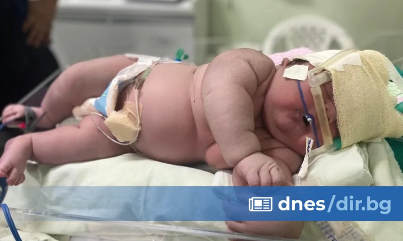 Бебе рекордьор проплака в бразилска болница на 18 януари, съобщиха