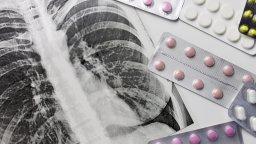 В половин България болните от туберкулоза са вече над средното ниво за страната