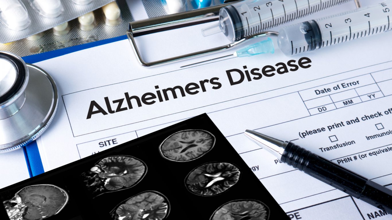 Повратна точка в лечението на Алцхаймер: Нов медикамент забавя развитието на болестта
