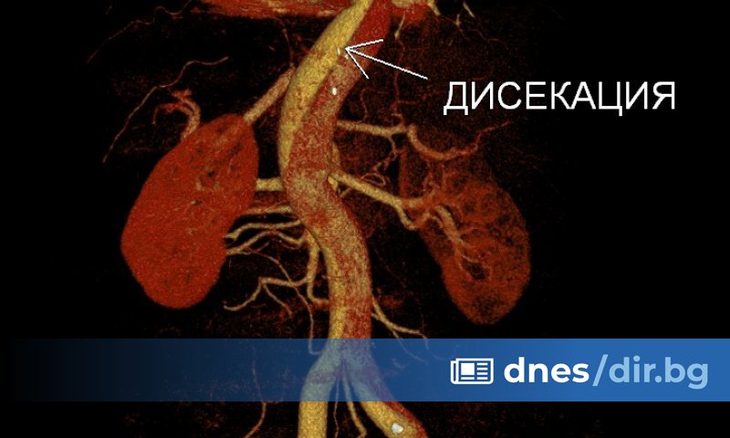 На 11 юни т.г. 49-годишният Румен посещава Спешното отделение на