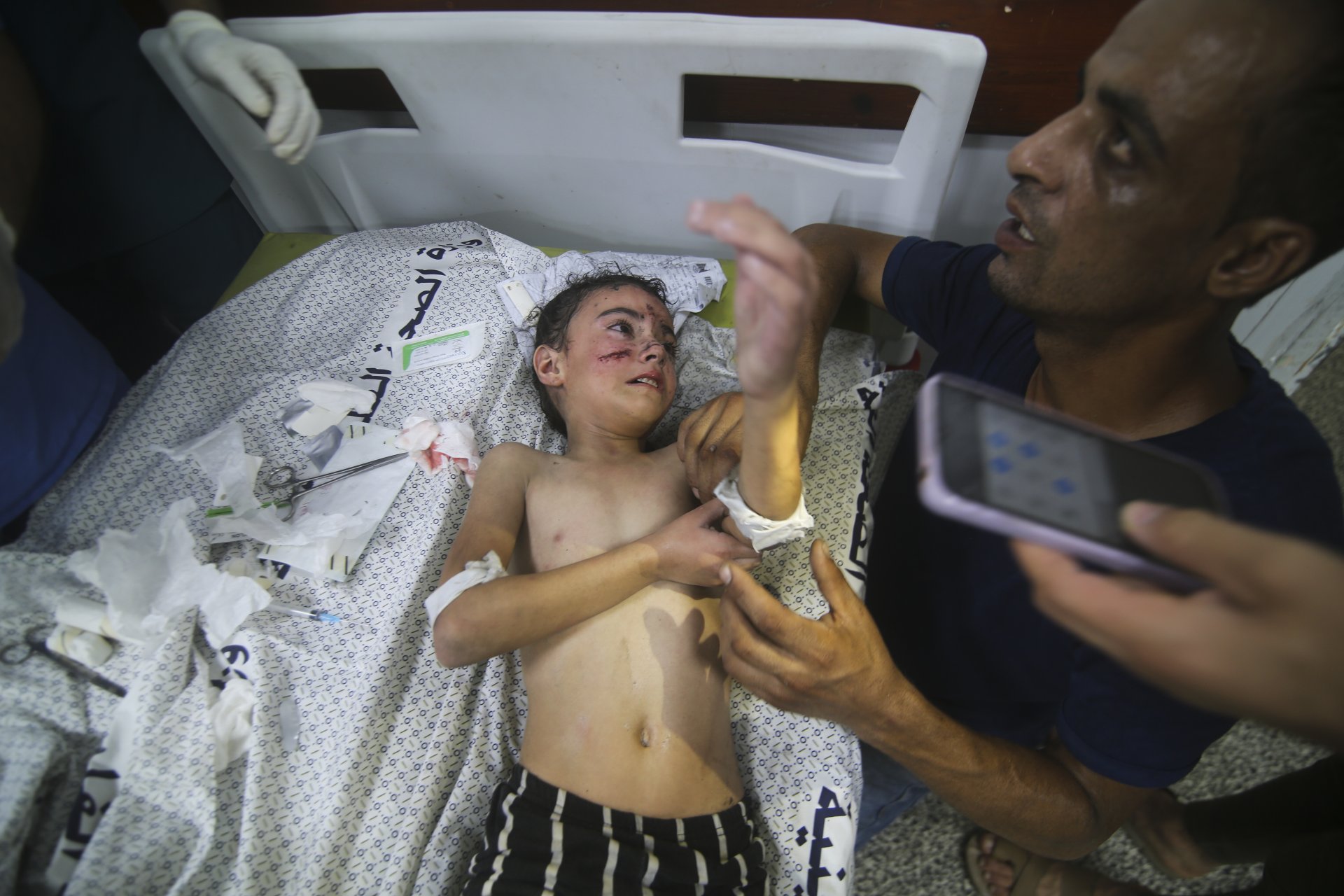 Ранено дете от израелските удари в Газа