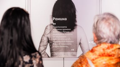 Източник Аджибадем Сити Клиник УМБАЛ Токуда Пластичната хирургия променя животи