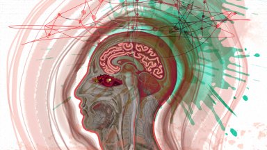 Наред със сърдечния и мозъчният удар се дължи на внезапно