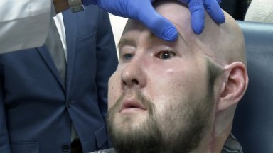 Американци извършиха първата в света трансплантация на цяло око