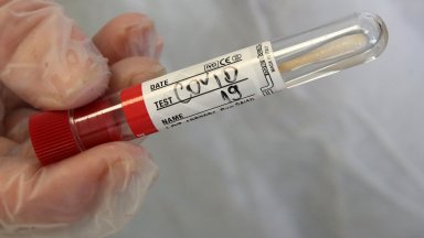 Общо направените тестове през изминалото денонощие са 718 От тях