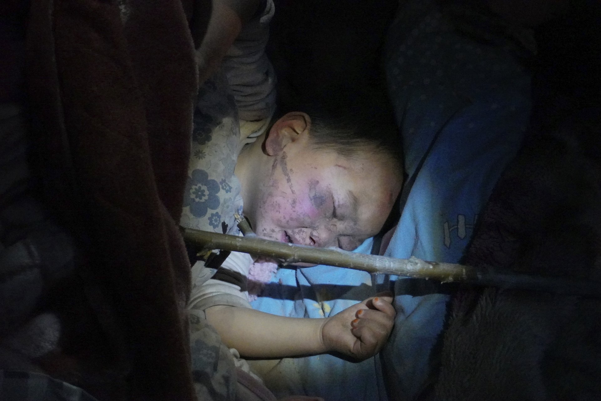 Дете, ранено при земетресение, заспива, след като е било лекувано и настанено в болница