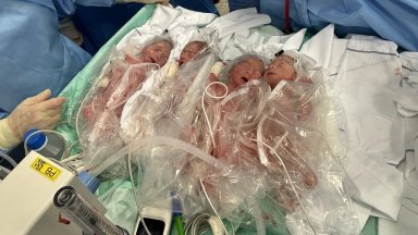 Момченцата които са еднояйчни близнаци и са спонтанно заченати са