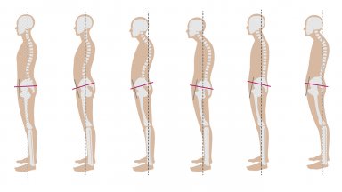 снимка Българската асоциация по постурология От какво се оплаква лице
