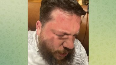 Колкото повече разследваме толкова по ясно става че операцията е била