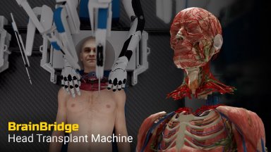 Концепция от бъдещето: Робот ще може да извършва трансплантация на глави