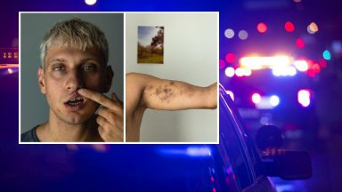 A man claims he was beaten by security guards at a famous Plovdiv discotheque