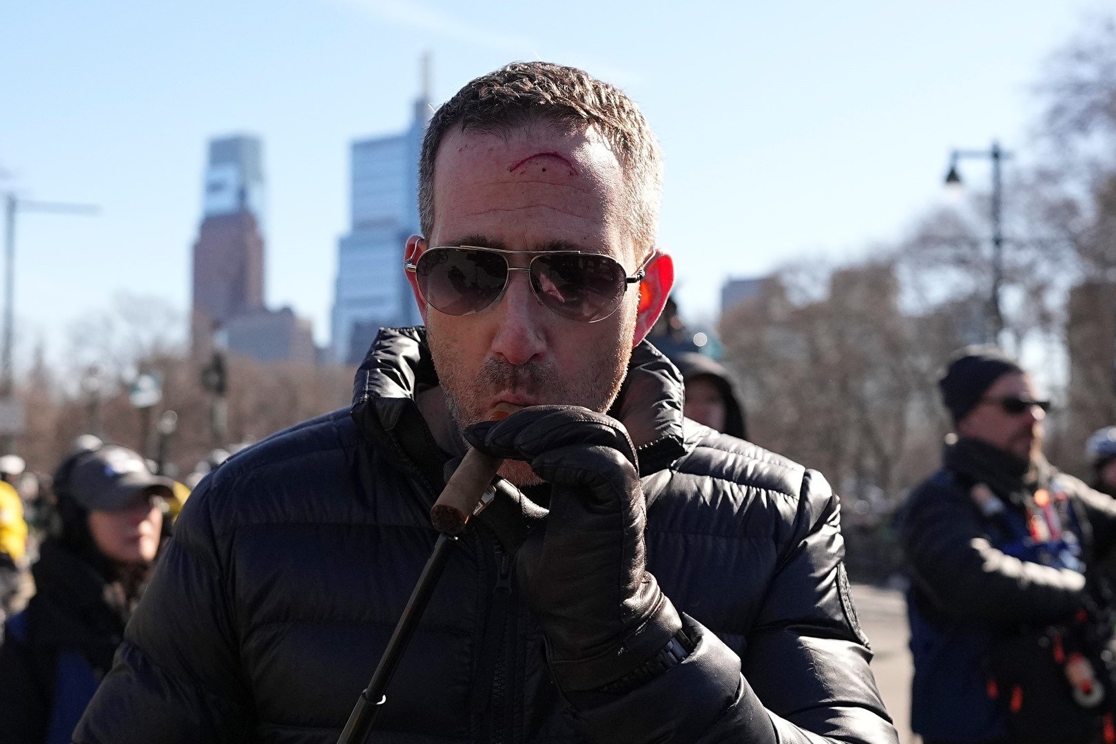 Хауи Роузмън пуши невъзмутимо пурата си, след като огромната рана на челото му бе зашита набързо