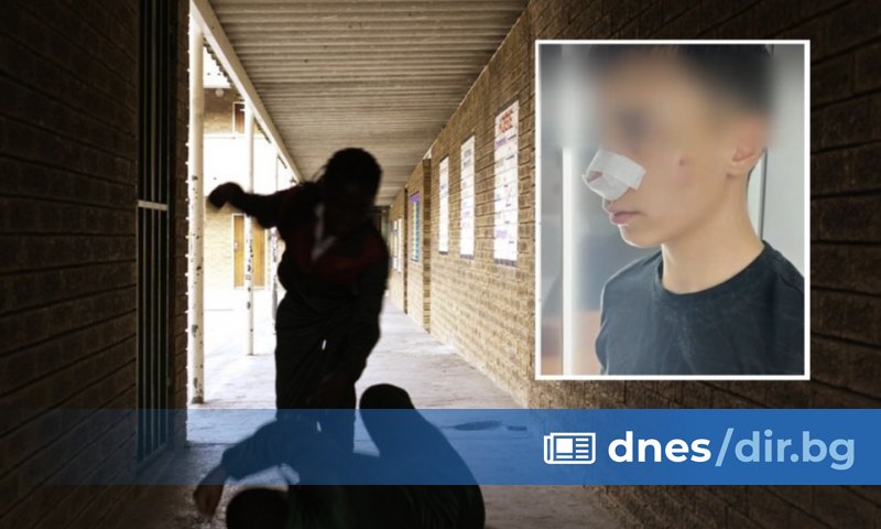 13-годишно момче е със счупен нос и комоцио след побой