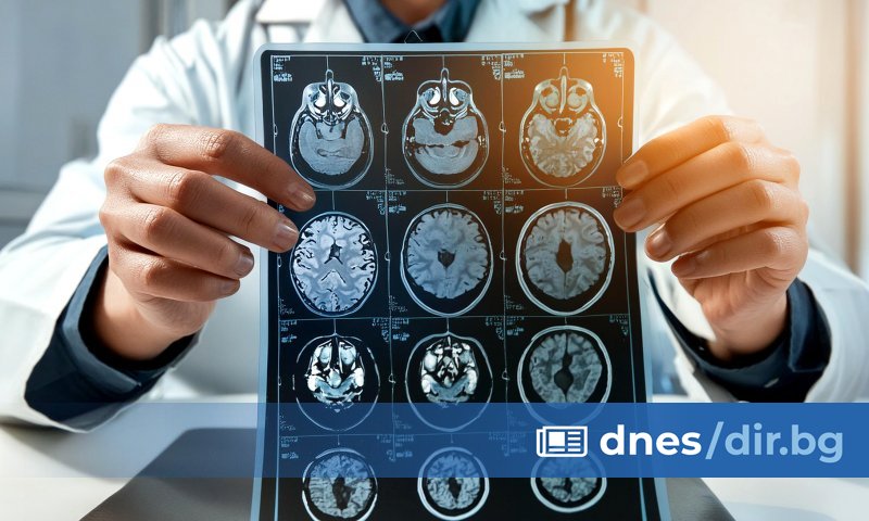 На всеки десет минути един българин получава инсулт, а на