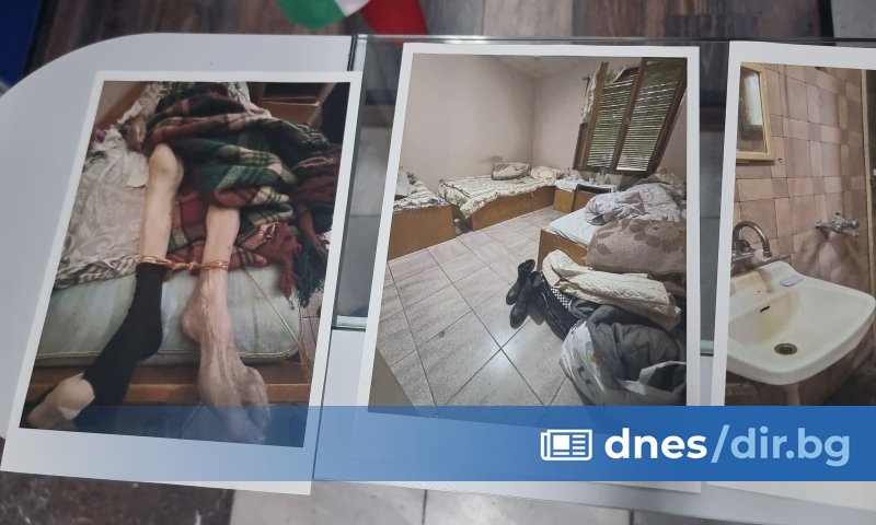 На жена на 89 г. са ампутирани два от пръстите