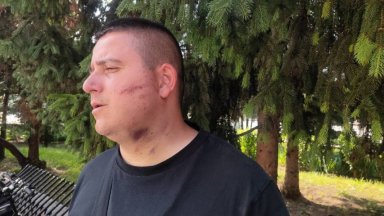 "Без отличителни знаци"": Разследват полицейско насилие в Силистра 