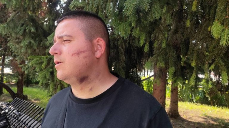 "Без отличителни знаци"": Разследват полицейско насилие в Силистра 
