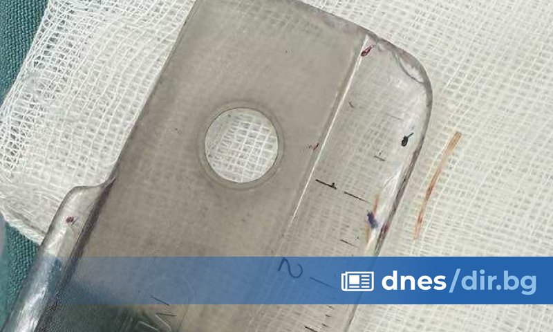 Лекари от Пловдив се сблъскаха с изключително рядък и необичаен