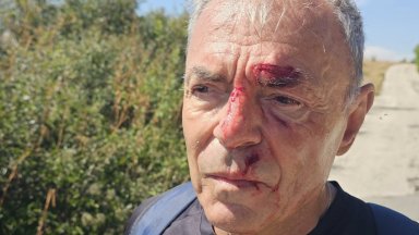 Бившият образователен министър Сергей Игнатов пострада вчера по време на