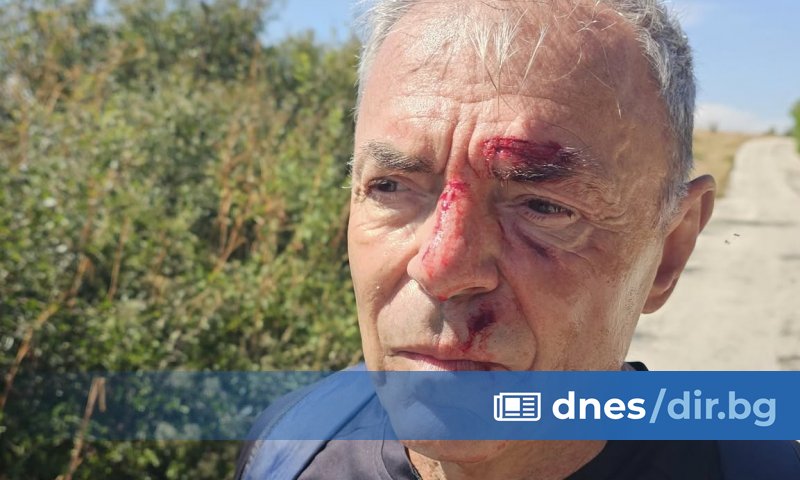 Бившият образователен министър Сергей Игнатов пострада вчера по време на