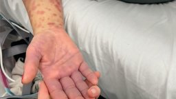 Затварят дома за стари хора в Поморие