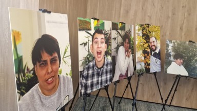 Епилепсията идва на фокус в нова изложба