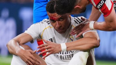 Мбапе ще играе с превръзка на окото в големия реванш срещу Байерн